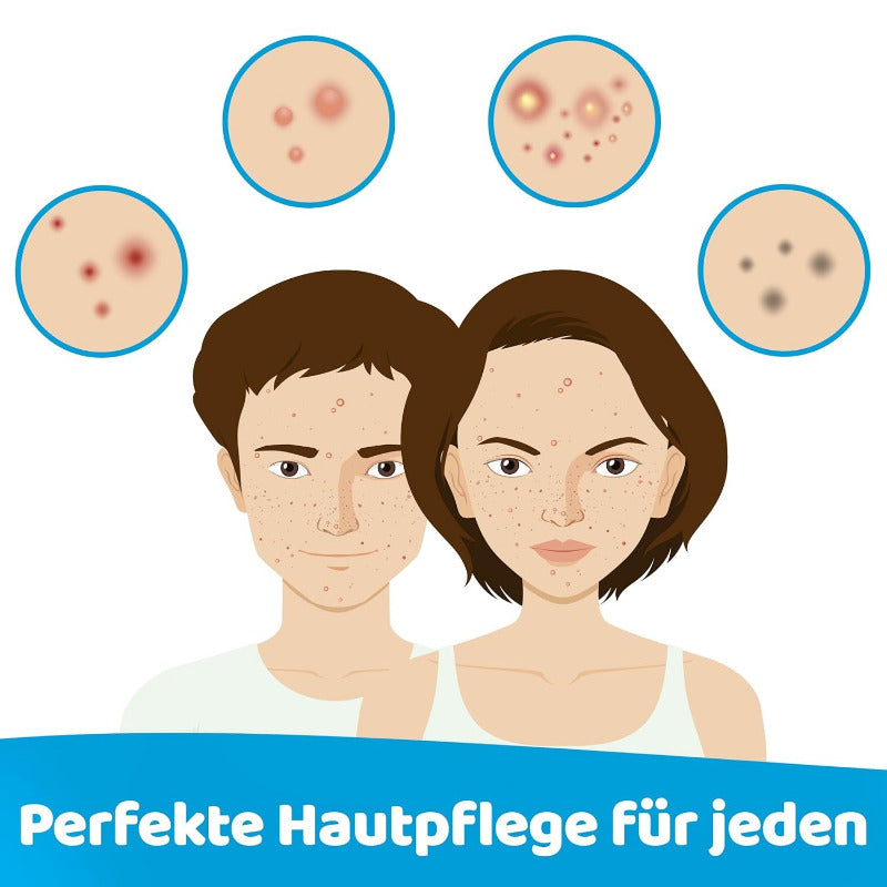 Prontomed Hypoclear Akne-Spray 75Ml – Effektive Hautpflege Mit Hypochloriger Säure/Hypochlorus Acid | Bei Akne, Hautunreinheiten Und Rötungen | Für Klare, Gesunde Haut – Schonend Und Wirksam!