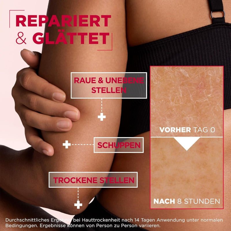 Mixa Urea Hauterneuernde Creme Mit Urea & Niacinamide, Für Trockene Und Raue Und Unebene Haut, Repariert Und Glättet, Feuchtigkeitspflege Für Den Körper, Hände Und Gesicht, Urea Cica Repair+, 400 Ml