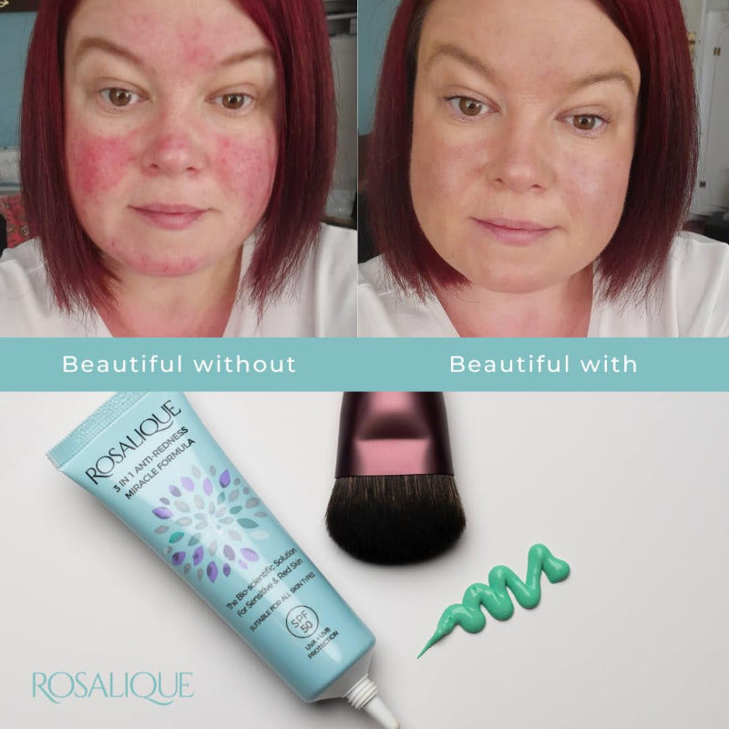 Rosalique 3 in 1 Anti-Redness Miracle Formula Colour Corrector SPF50 for Hypersensitive and Redness Prone Skin, Suitable for All Skin Types 1 X 30 Ml
