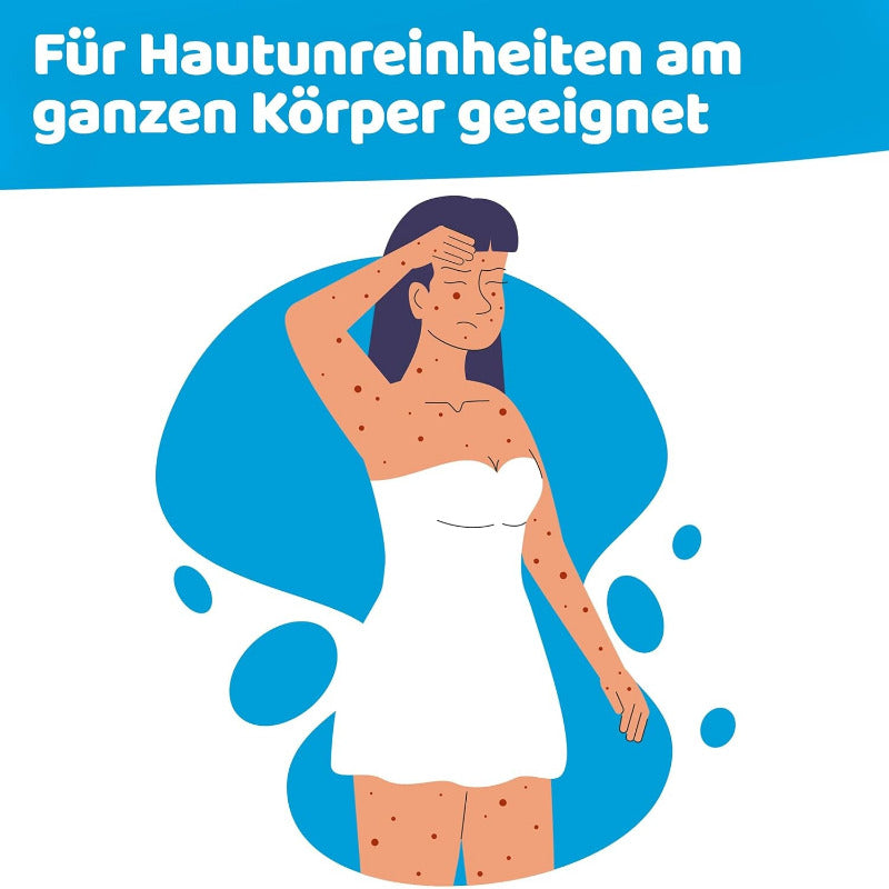 Prontomed Hypoclear Akne-Spray 75Ml – Effektive Hautpflege Mit Hypochloriger Säure/Hypochlorus Acid | Bei Akne, Hautunreinheiten Und Rötungen | Für Klare, Gesunde Haut – Schonend Und Wirksam!