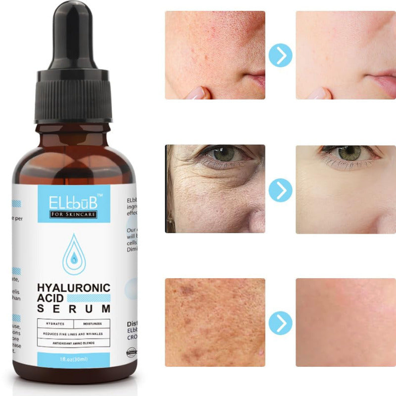 Gesichtspflege Serum Set Mit Vitamin C Serum Hyaluron Serum - Gegen Falten, Trockene, Matte Haut & Dunkle Flecken, Anti-Aging-Pflege Für Einen Frischen Glow Und Ebenmäßigen Teint
